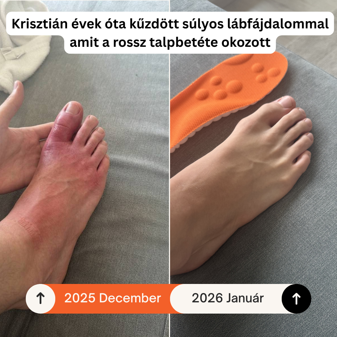 Memóriahabos Talpbetét